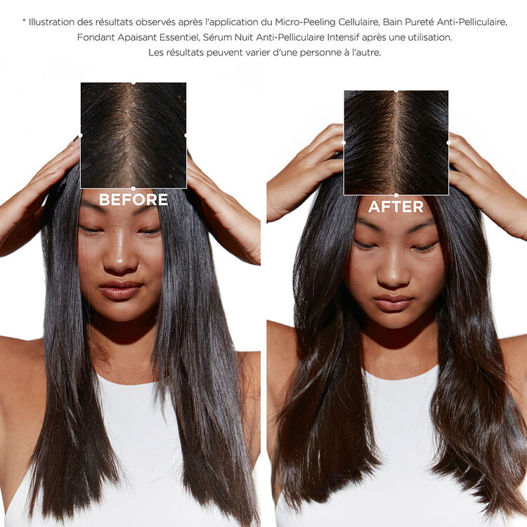 Quatuor Symbiose anti-pelliculaire cuir chevelu gras et sensible