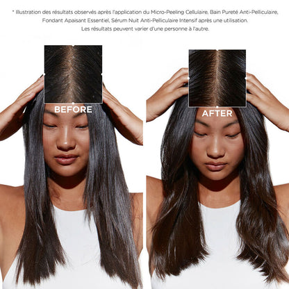 Quatuor Symbiose anti-pelliculaire cuir chevelu gras et sensible